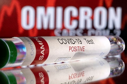 Representative image.