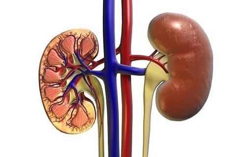 Chronic Kidney Disease (Image Courtesy : ANI))