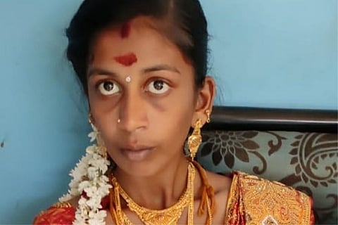 Forced To Discontinue College To Get Married, Chennai Teen Dies After Consuming Poison
