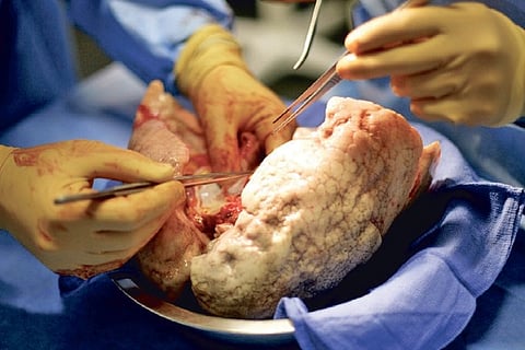 Representative Image