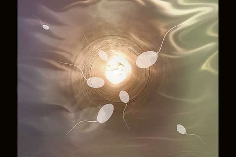 Representative Image