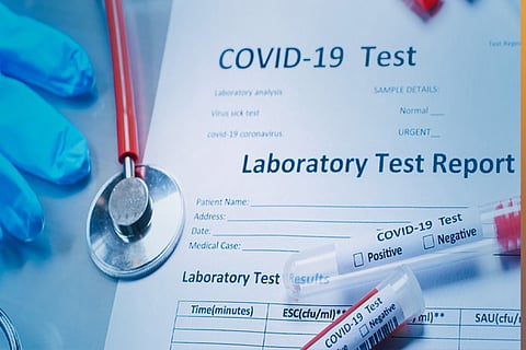 Representative Image