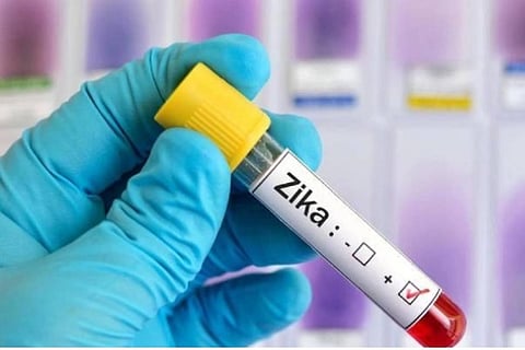 Representative Image