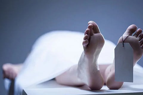 Representative image