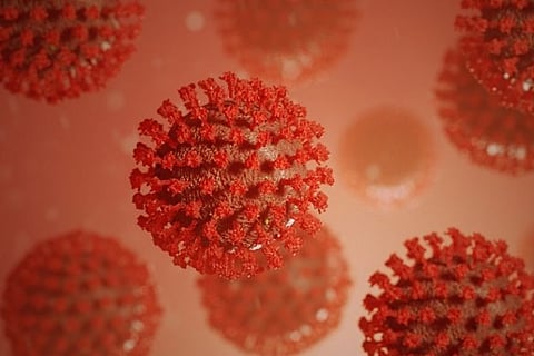 Representative image