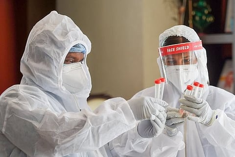 Representative image