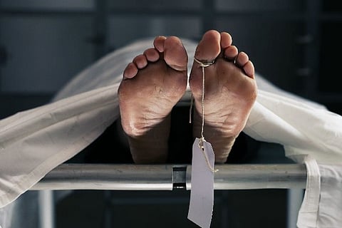 Representative image