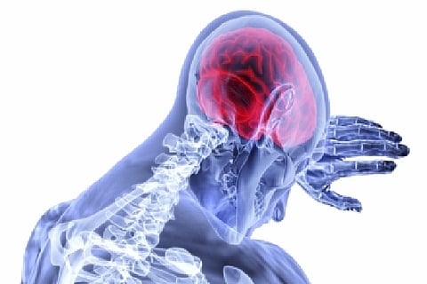 This study examined the risk of ischemic stroke, which is a stroke due to a blocked blood vessel