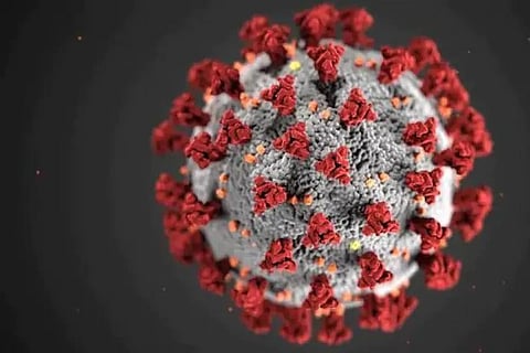 Representative image