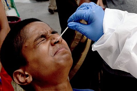 Representative Image