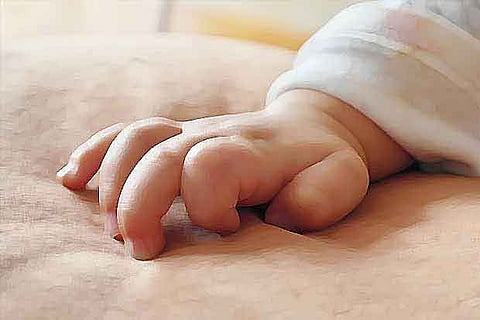 Representative image