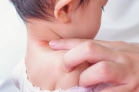 Representative Image (Image Credit: IANS)