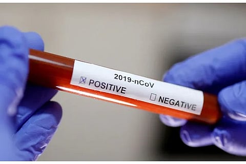 Salem Collector, Thanjavur SP test positive for COVID infection