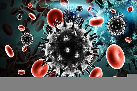 Representative Image