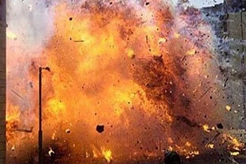 Representative Image