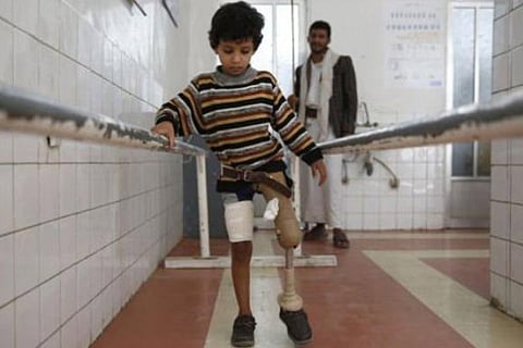 A young kid who is a war  victim