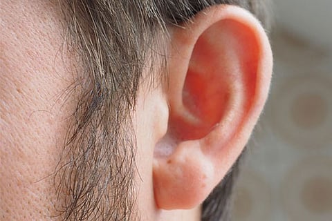 The above picture is a representational image