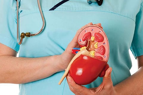 Representative Image