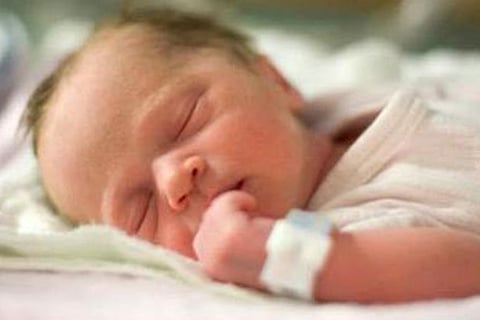 Representative Image