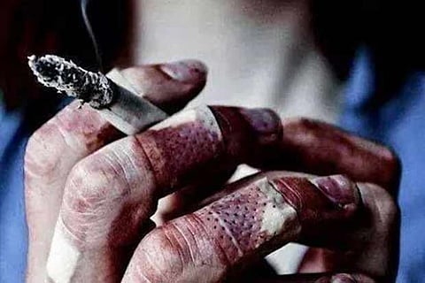 Representative Image