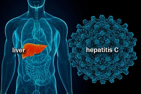 First self-test for hepatitis C virus prequalified by WHO