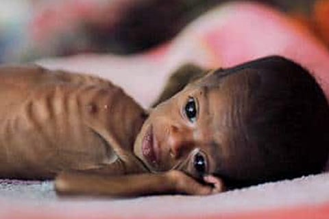 Representative Image