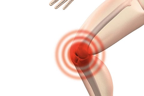 Representative Image