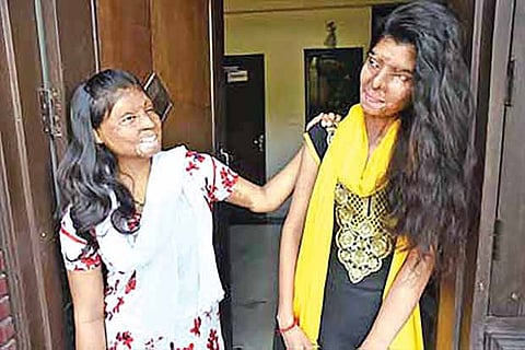 Acid attack victims Ritu and Rupa were approached by a filmmaker to feature in a documentary