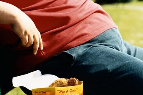 Representative Image