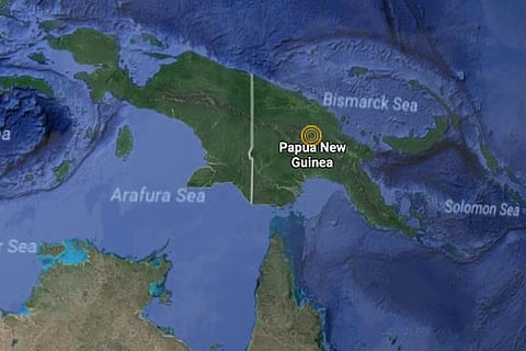 Representative image