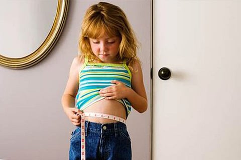 Representative image