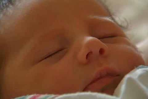 Representative Image