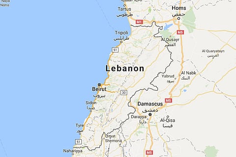 Representative Image