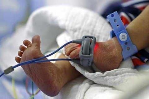 Representative Image