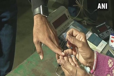 Representative image