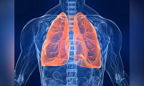 Study finds 1 in 3,000 people at risk of punctured lung from faulty gene
