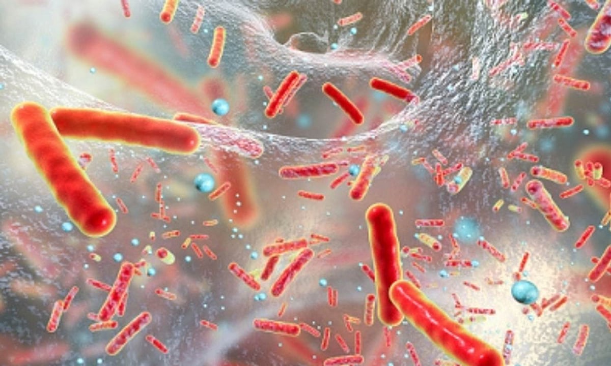 New species of superbug behind spike in severe human infections