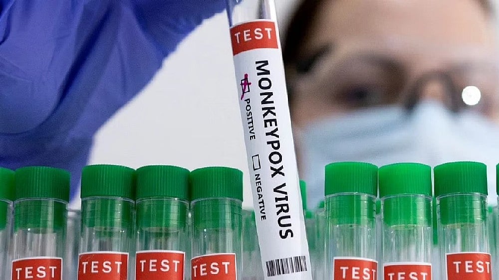 ICMR-NIV analysis finds A.2 strain of first two monkeypox cases