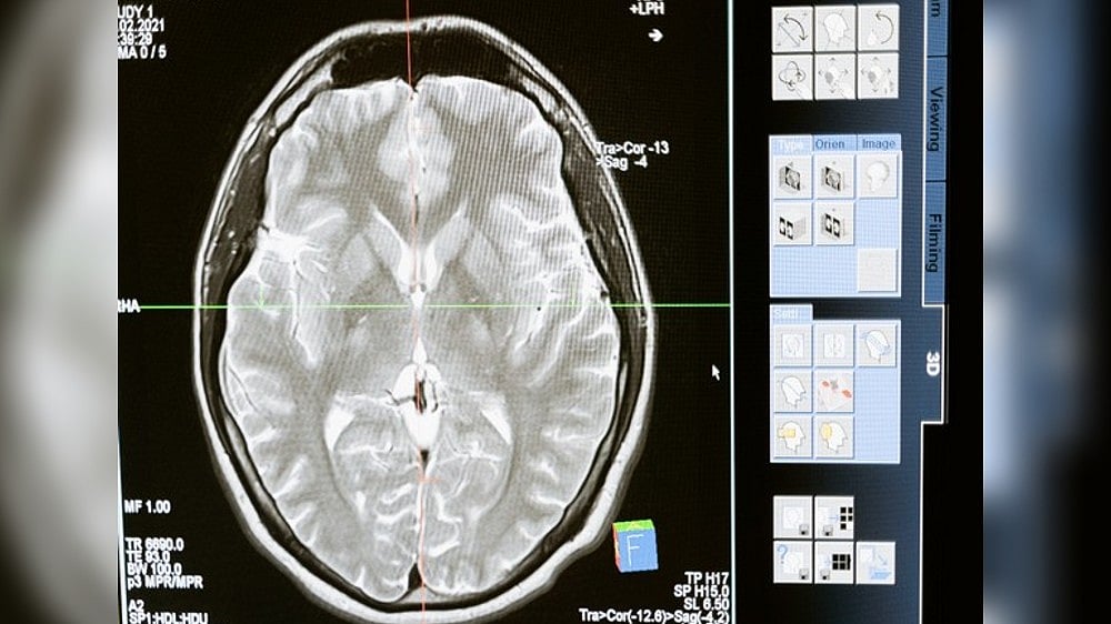 Fungal intruder shrinks, develops to aid infection spread: Study