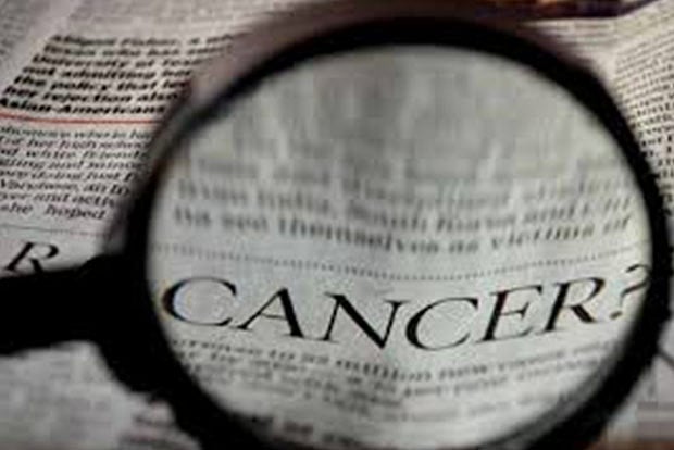 Colon Stiffness Linked to Higher Early-Onset Colorectal Cancer Risk