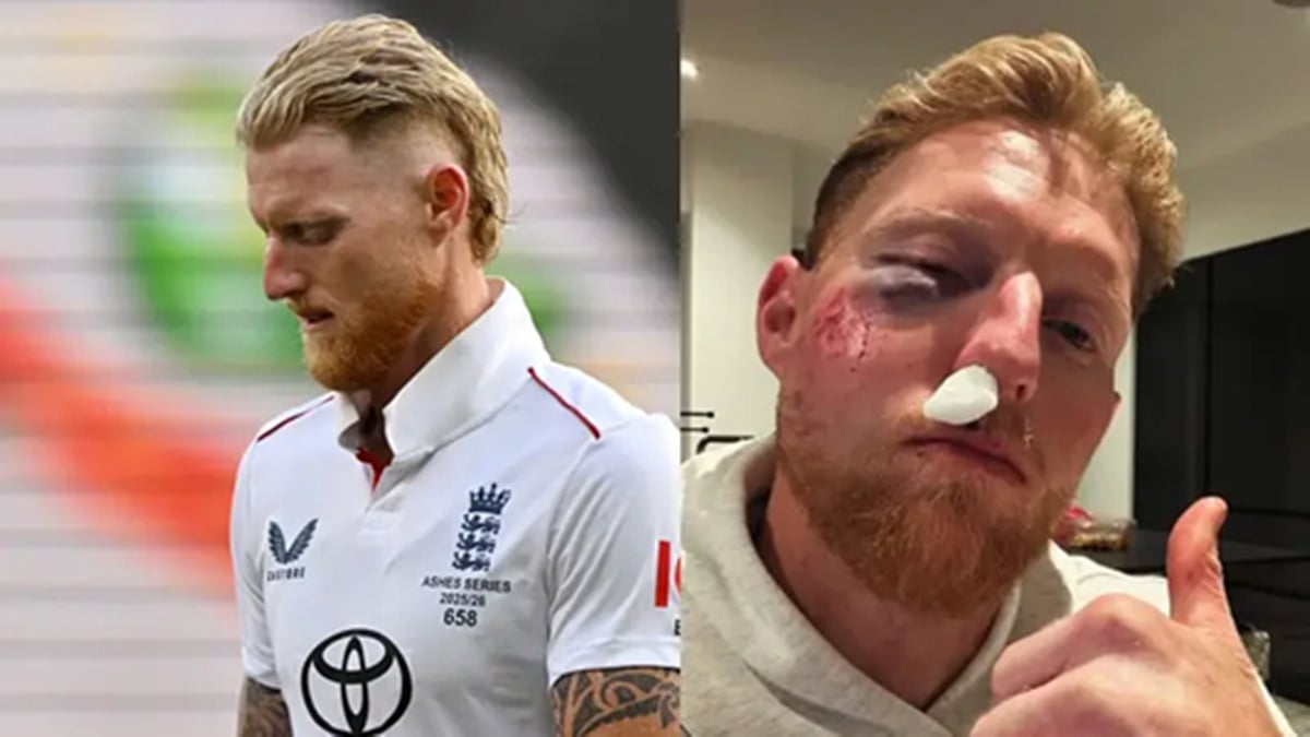 Ben Stokes Injury Update: চোখের নিচে কালশিটে, গালে ক্ষত, নাকেও চোট— বেন ...