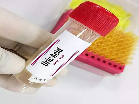 Shon-sharaf teshigi nima?