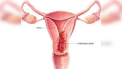 “Mening adolatli enagam” komediyasida Zavorotnyuk yalang‘och holda tasvirlangan.