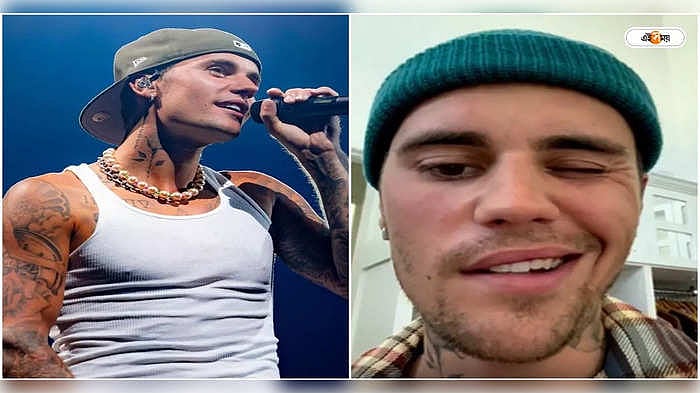 চোখের পাতা পড়ছে না, অর্ধেক মুখ অবশ! কঠিন রোগে আক্রান্ত Justin Bieber ...