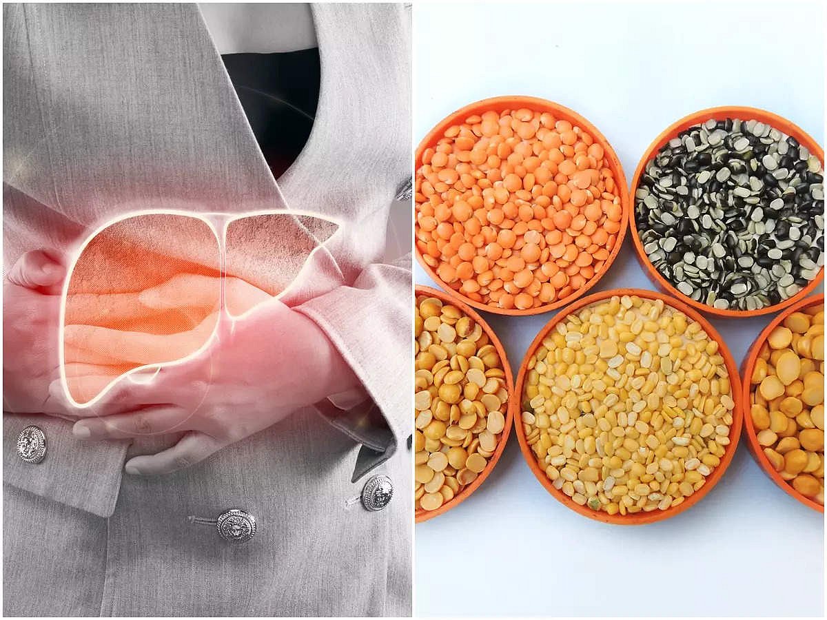 Fatty liver diet 