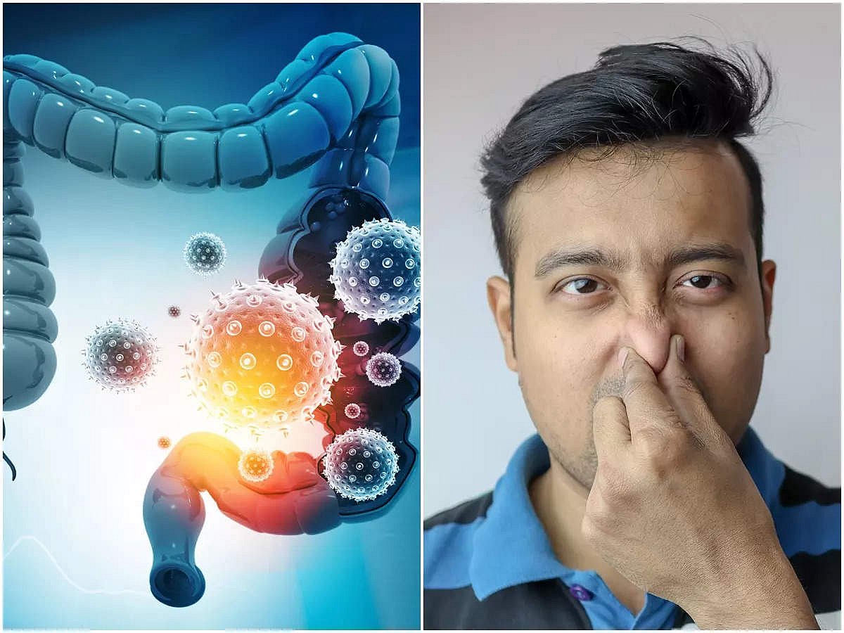 Why Does Stomach Gas Form: কেন পেটে গ্যাস হয়? দুর্গন্ধের কারণ কী ...