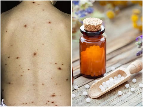 Yalangoch shemale rasmlar