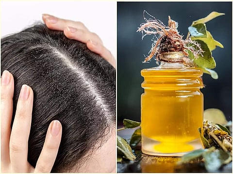 Legginglarda jingalak dumbalarning fotosuratlari