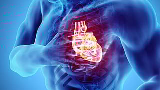 Cardiac Arrest: Causes, Symptoms, and Immediate Treatment