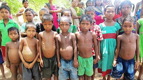 State Government : More than 1.37 lakh children malnourished in the state; State Government's admission in the High Court